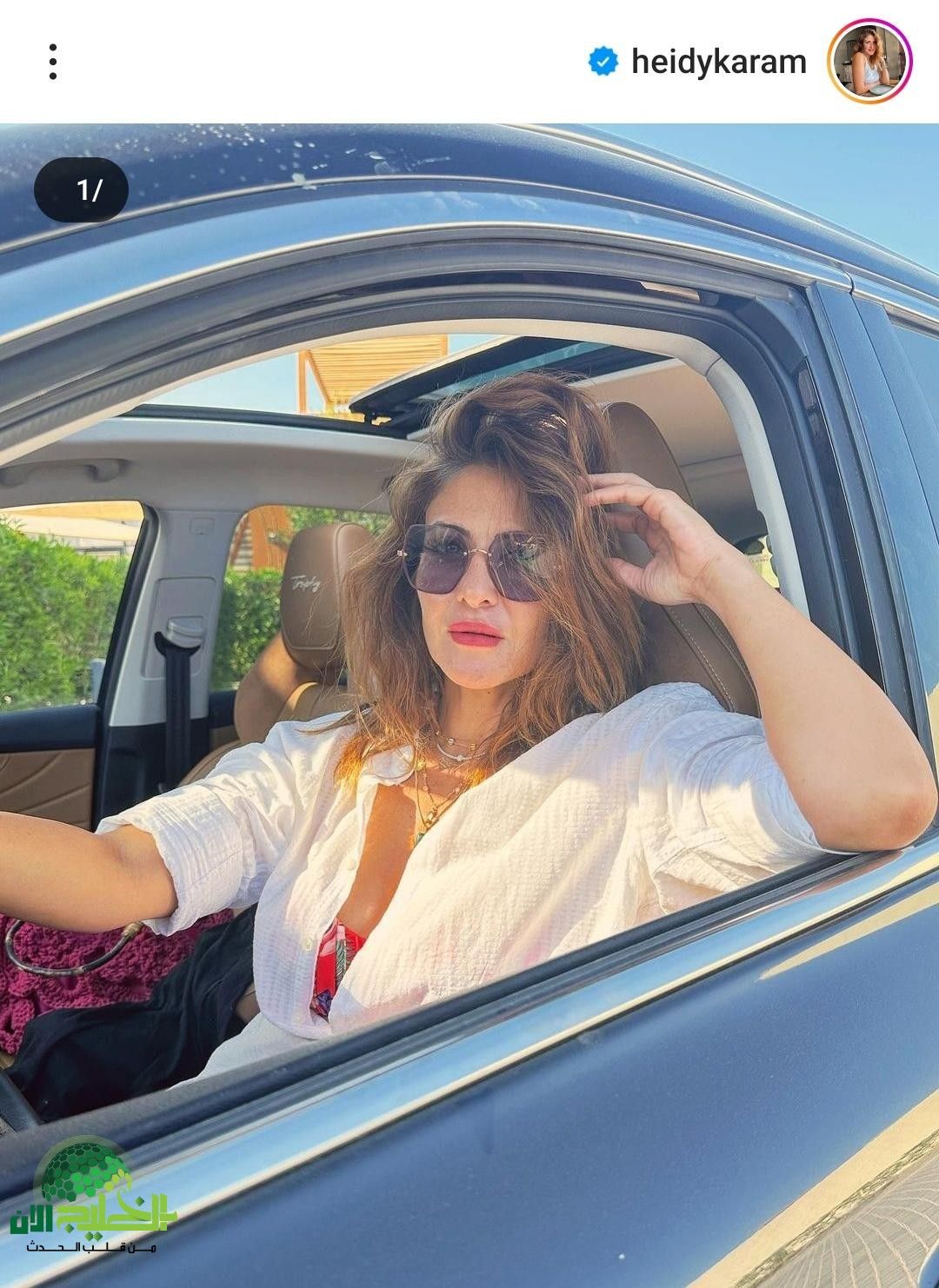 هيدي كرم تتحدى هوس الكمال وتدعو للعودة إلى الجمال الطبيعي(1)