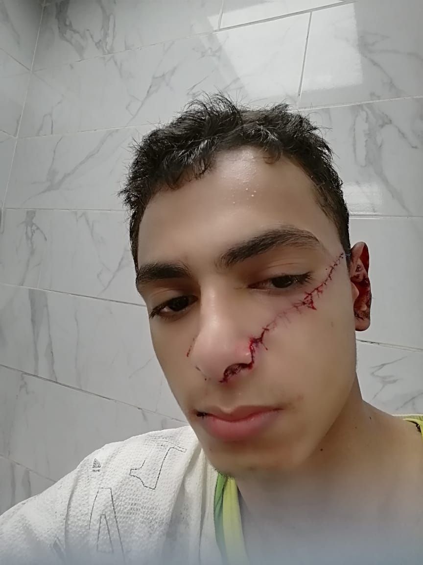 المجنى عليه (1) المجنى عليه (1)