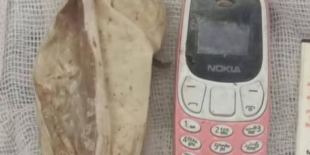 الفريق الطبي بمستشفى ناصر العام بشبرا ينجح في استخراج "موبيل" من معدة مريض بعد 4 شهور (صور) - تكنو بلس