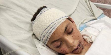إيطاليا
      ستستقبل
      طفلًا
      فلسطينيًا
      نجا
      من
      القصف
      الإسرائيلي
      الأسبوع
      المقبل - تكنو بلس