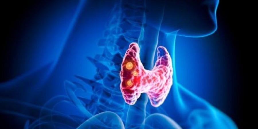 طرق
طبيعية
لدعم
الغدة
الدرقية
وتحسين
وظائفها - تكنو بلس
